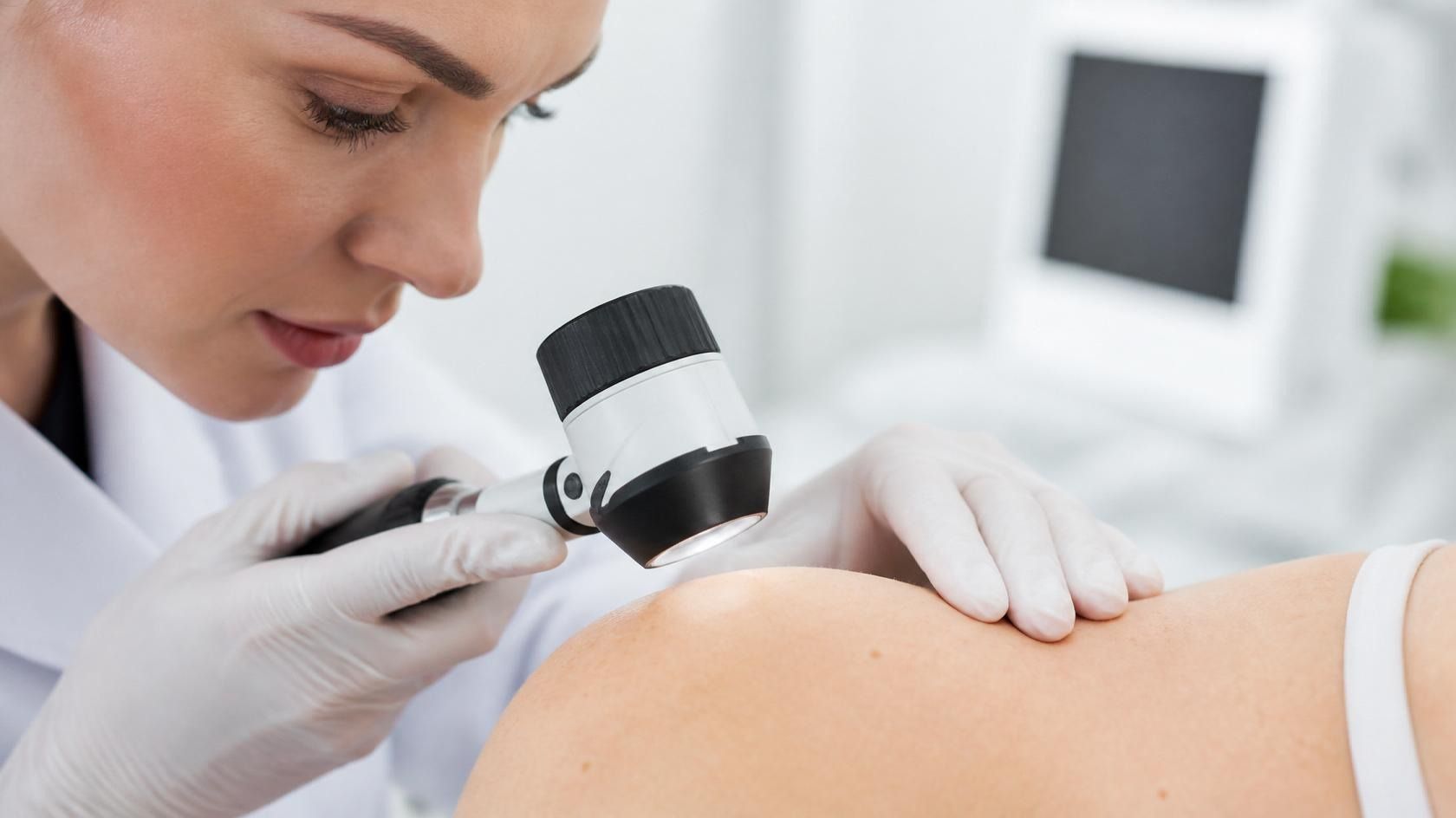 Dermatologist examining a patient's skin with a dermatoscope during a skin check
